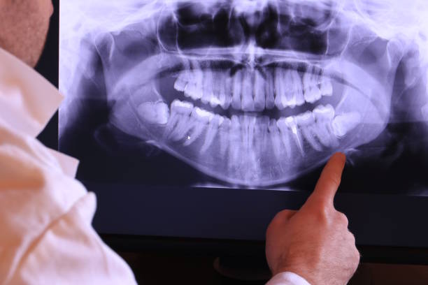 Best Orthodontic Emergency Dentist in Mccoll, SC