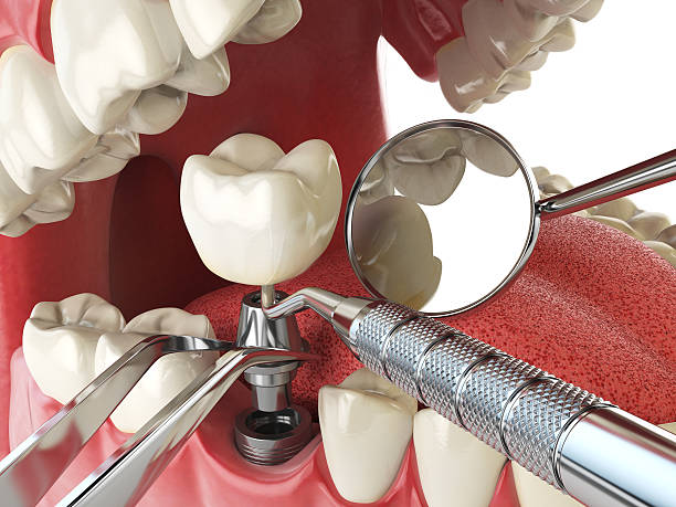 Best Emergency Dentist for Lost Fillings or Crowns in Mccoll, SC
